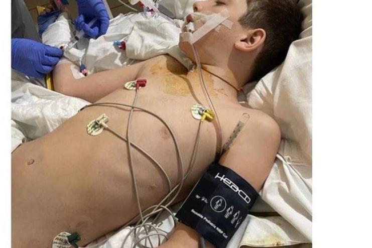 10-річний хлопчик стрибнув із 6 поверху через гру у "Синього кита"